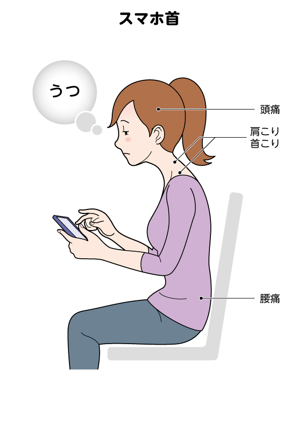 スマホ首・巻き肩・ストレートネック…現代人に増える首の痛みと対処法
