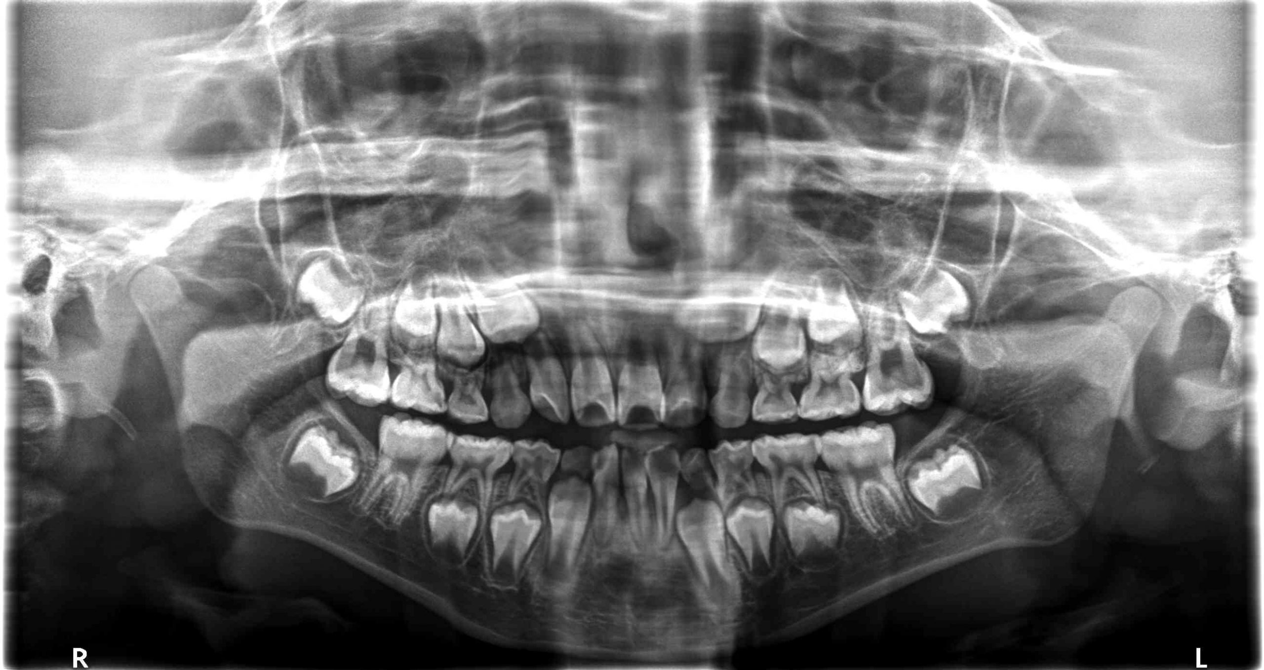 歯科のレントゲンは安全！？歯科のレントゲンの被曝について｜Doctor