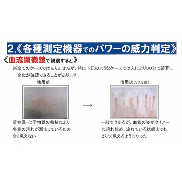 ゴッドクリーナーゴールド(足浴器)用電極カートリッジ / プロ専用