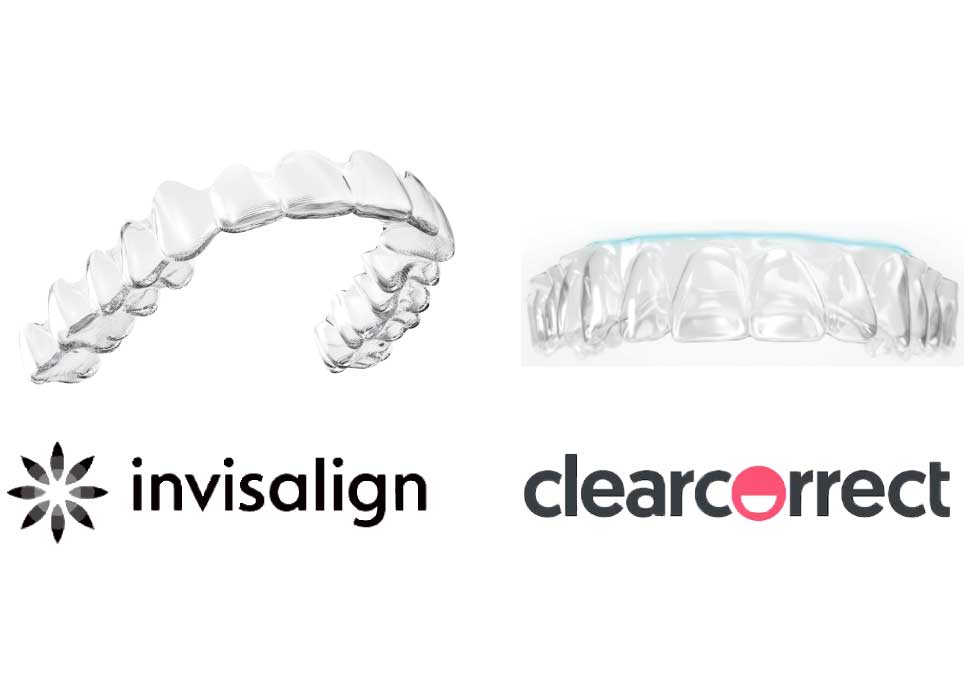 部分矯正で前歯を治したい！コンプレックス解消したい！歯列矯正は湘南