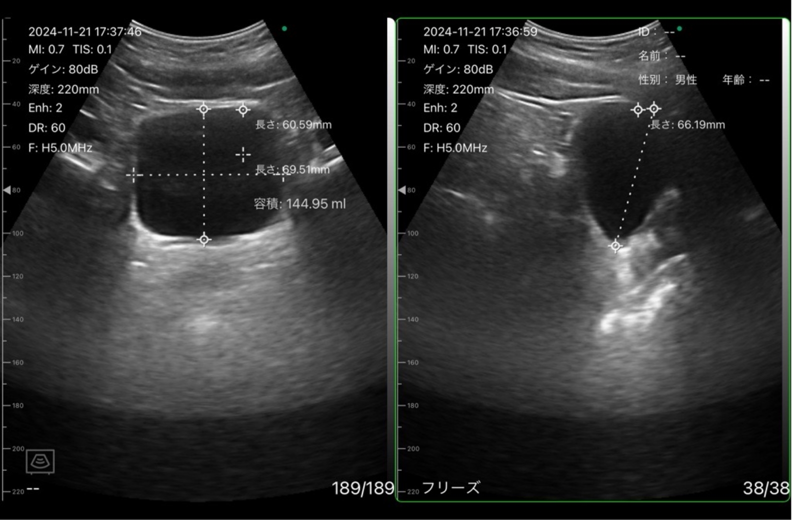 汎用超音波画像診断装置ポケットエコー miruco CL5