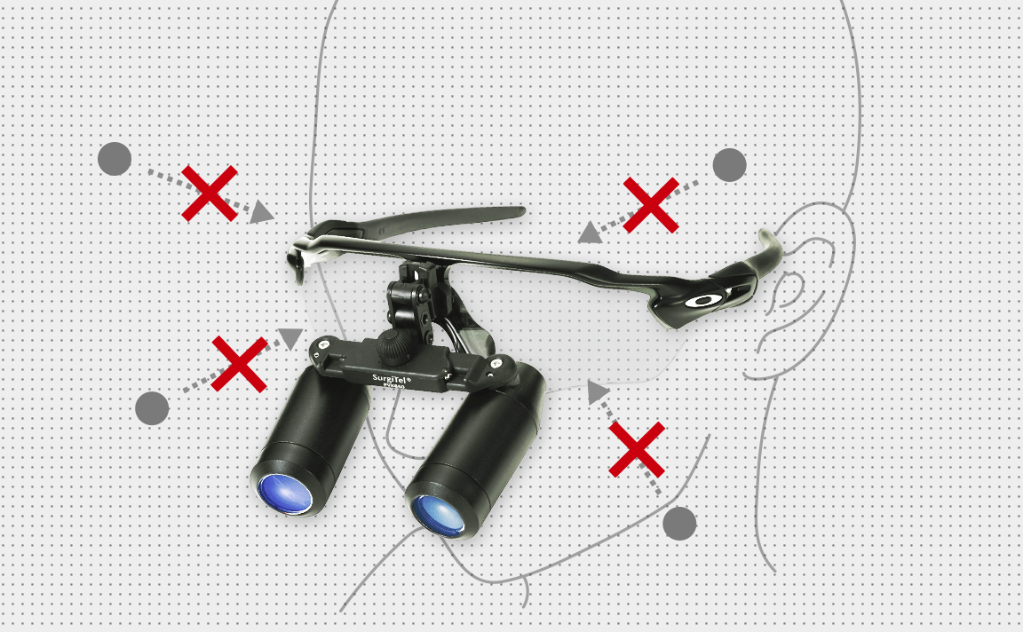 Radar EV｜Surgitel～拡大鏡サージテル～歯科専用サイト