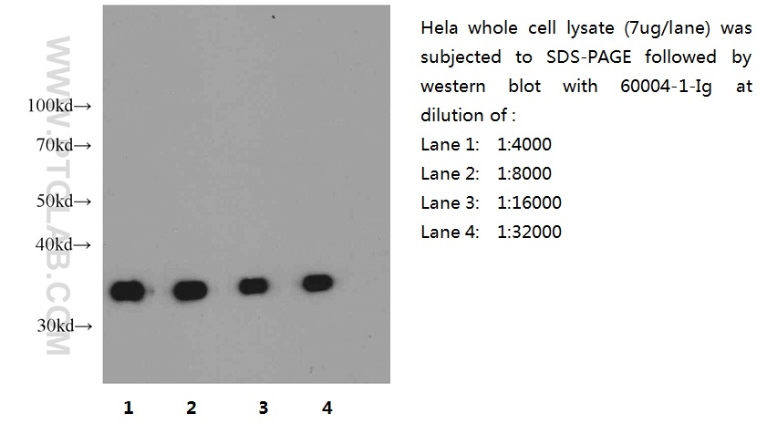 GAPDH antibody (60004-1-Ig) | Proteintech | 武汉三鹰生物技术有限公司