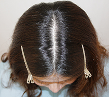 公式】発毛専門 リーブ21