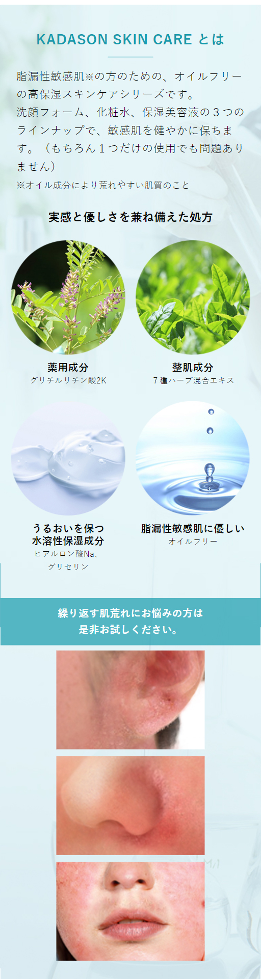 楽天市場】【公式】カダソン薬用セラミド化粧水／脂漏肌の赤み、かゆみ