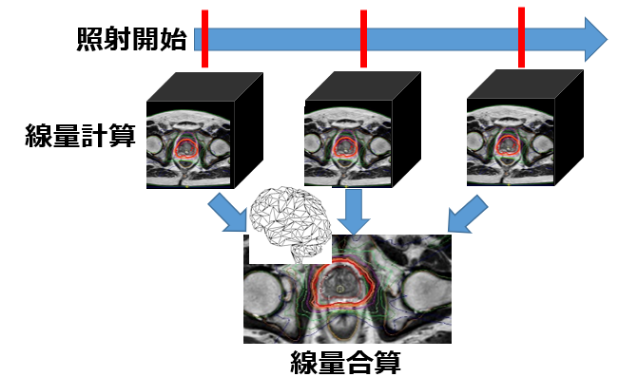 研究紹介 – 東北大学大学院医学系研究科 放射線腫瘍学分野 医学物理