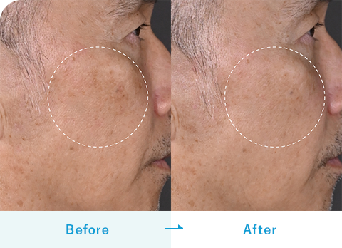 TXA濃縮美容液（ダームエデン）｜内服・外用薬・その他商品なら湘南