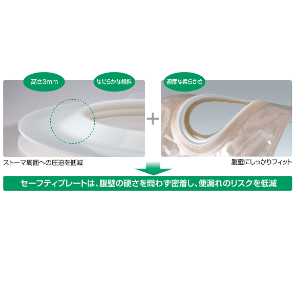 セルケア1・TDs 50φ / ウエル・カム サポートセンター