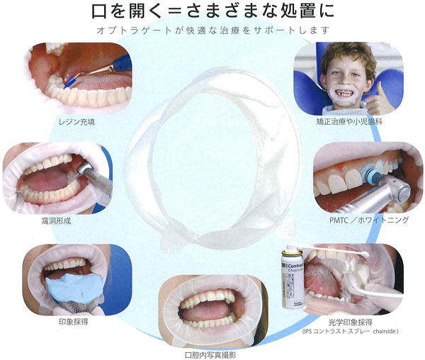 ラバーダム・開口器