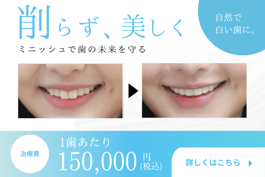 審美歯科 | 八王子市のとも歯科ゆり矯正歯科