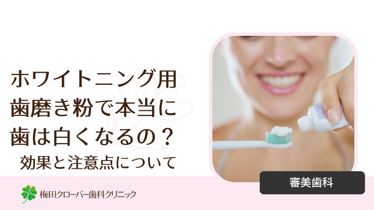 審美歯科｜梅田クローバー歯科よくあるご質問