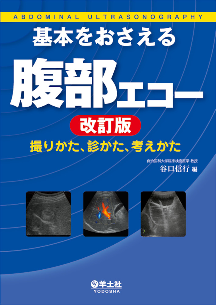 基本をおさえる腹部エコー 改訂版〜撮りかた、診かた、考えかた - 羊土社