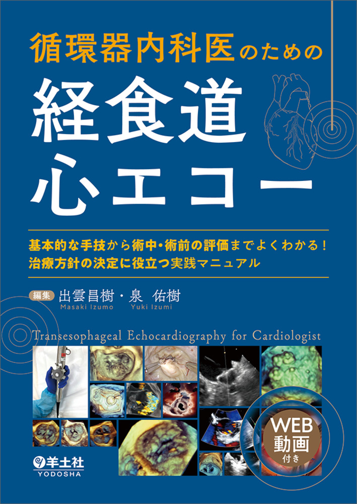 循環器内科医のための経食道心エコー〜基本的な手技から術中・術前の
