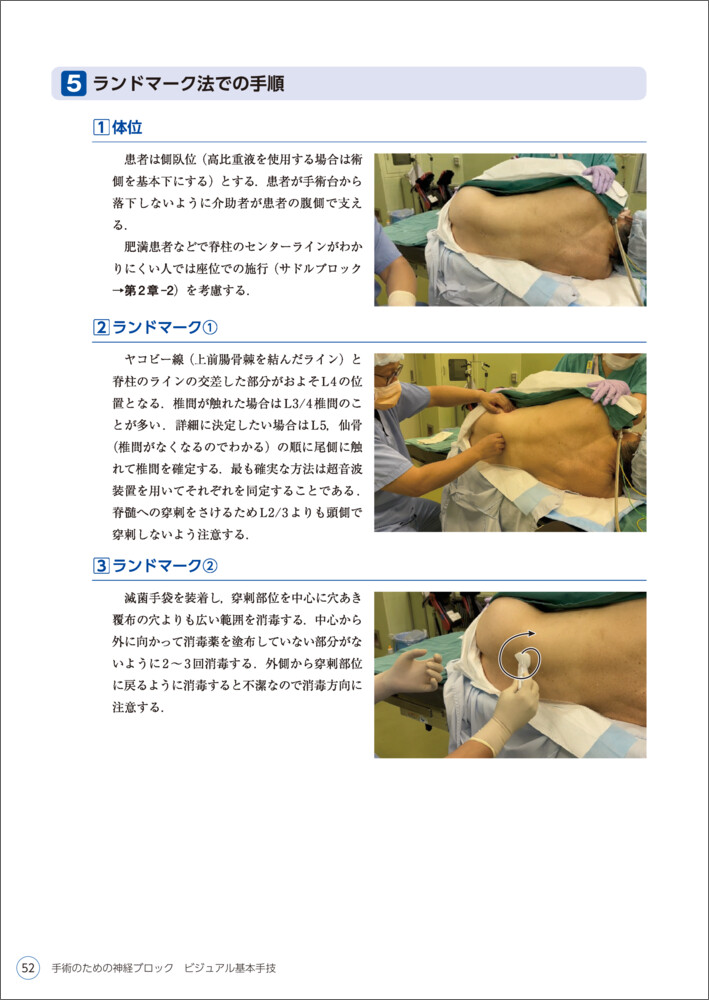 手術のための神経ブロック ビジュアル基本手技〜麻酔科医が知りたい