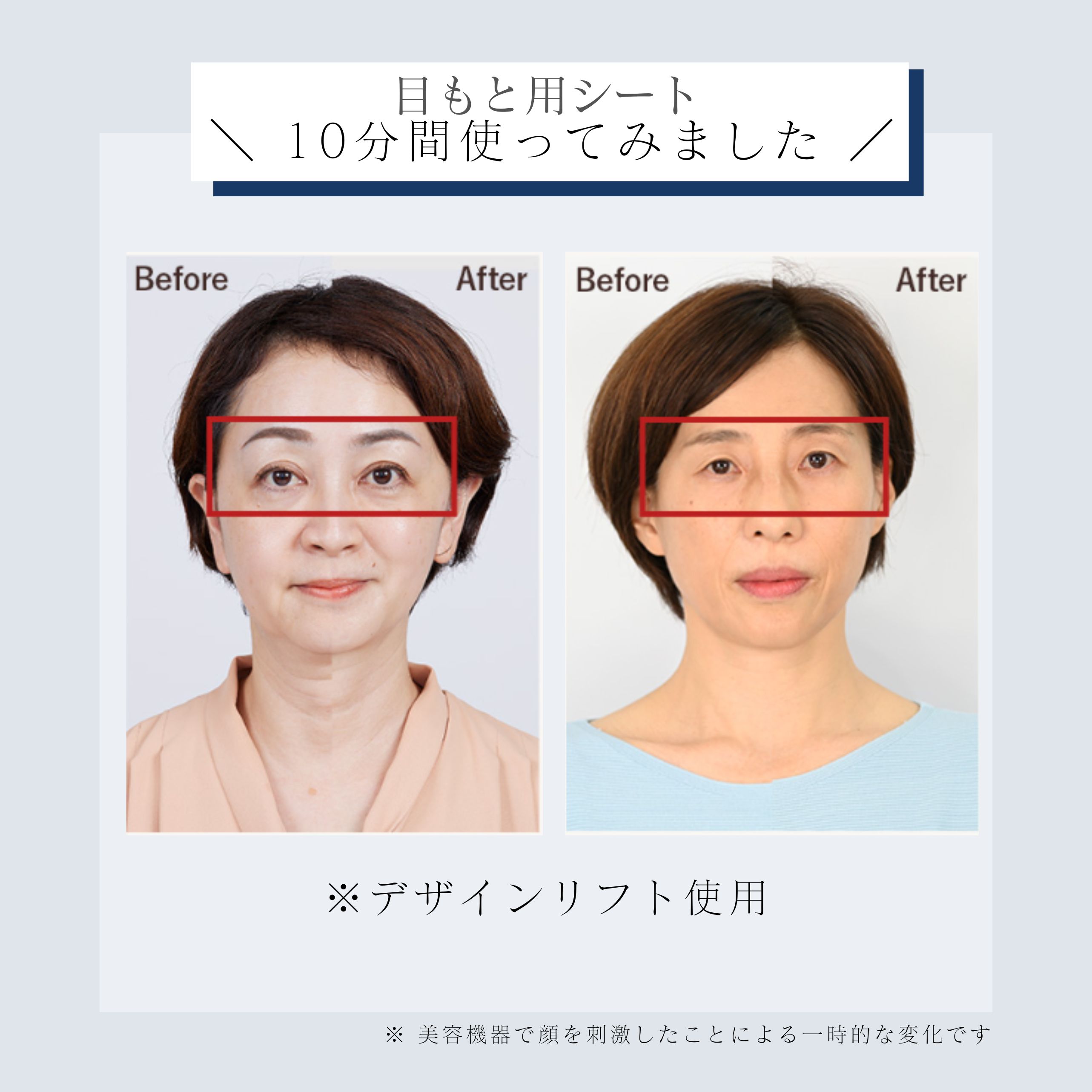 デザインリフトモア目もと集中4か月コース（C1）｜ヤーマン公式通販