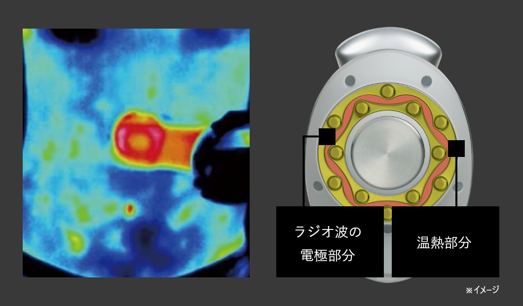 キャビスパ プレステージ for Salon｜YA-MAN PROFESSIONAL (ヤーマン