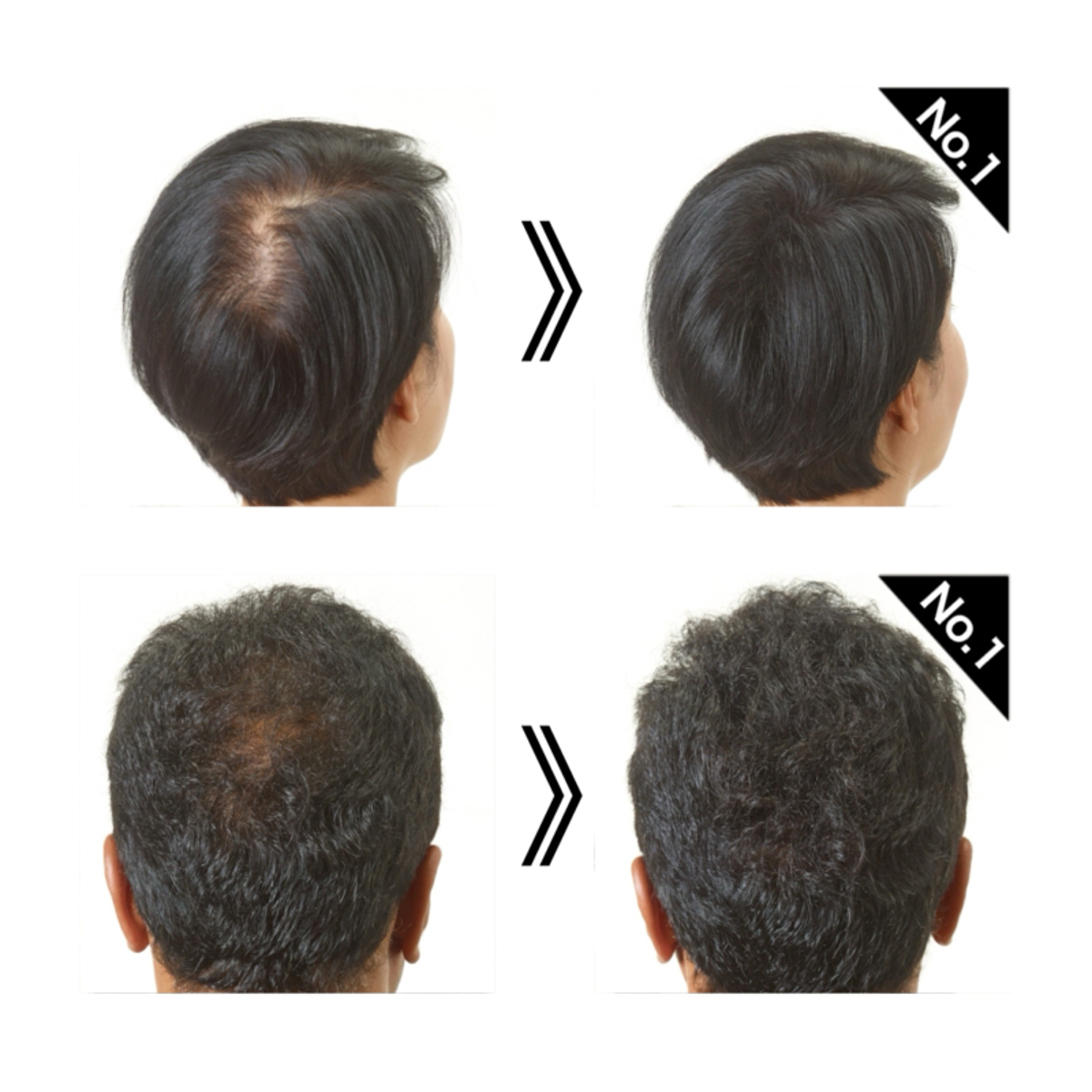 スーパーミリオンヘアーEX トラベルセット | かぜとゆきオンラインショップ