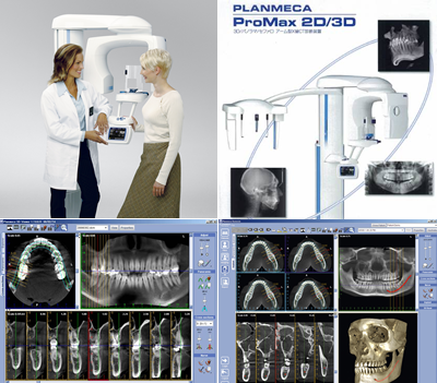 デジタルレントゲン｜愛知県田原市の山内歯科医院