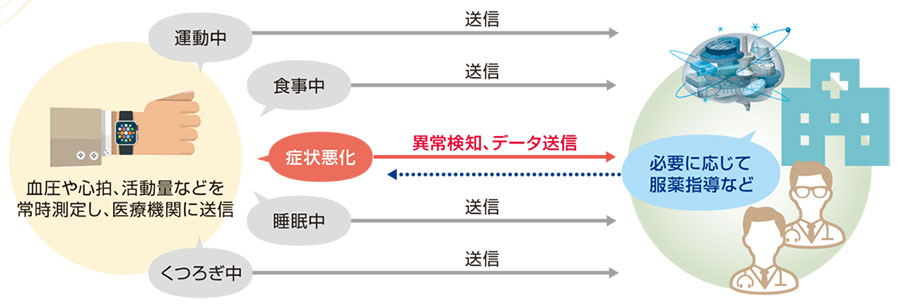ウェアラブル端末で常時遠隔モニタリング | 日経クロステック（xTECH）