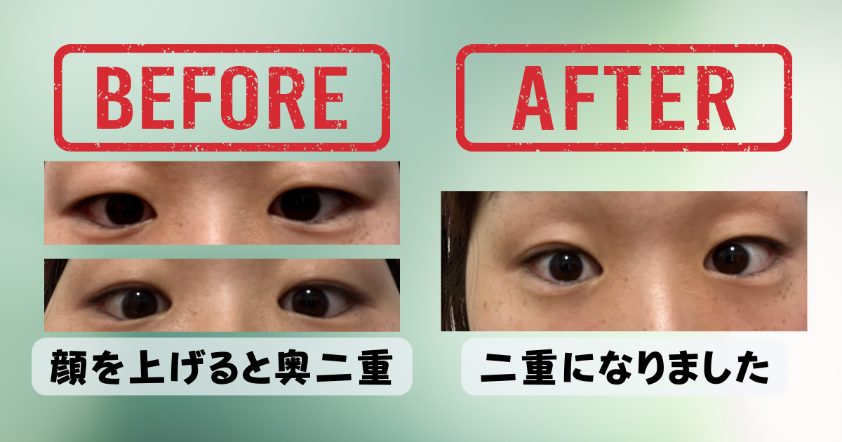 ナイトアイボーテ ナイトアイボーテ ナイトアイボーテ ナイトアイ