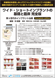 ワイド・ショートインプラントの基礎と臨床 完全版 第5世代の