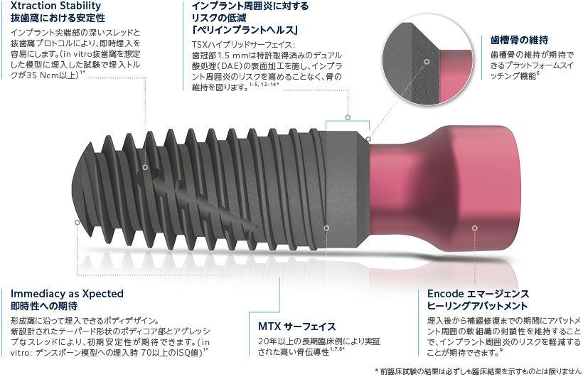 TSXインプラント｜インプラント｜ジンヴィ・ジャパン