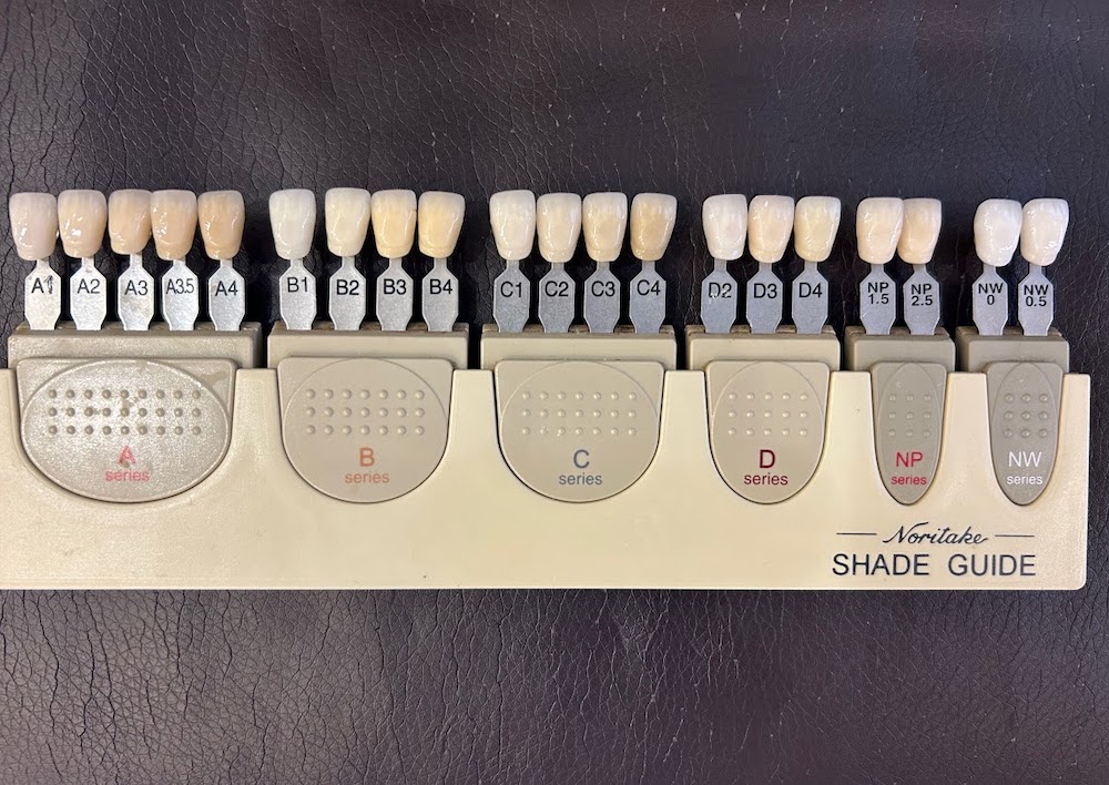 前歯のセラミックで失敗しない色と素材の選び方｜種類・費用・症例解説