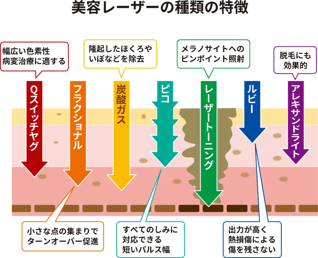 ピコレーザーの種類と機種別の特徴！5種からどれを選ぶ？ - 美容医療を