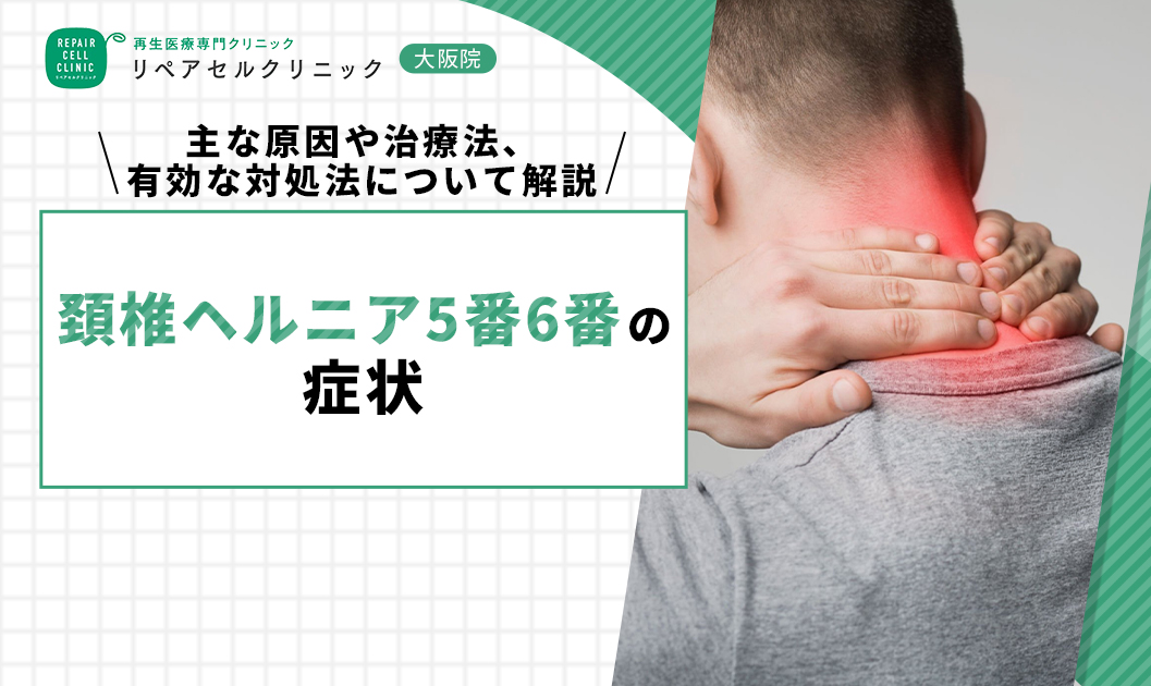 頚椎ヘルニア5番6番の症状｜主な原因や治療法、有効な対処法について