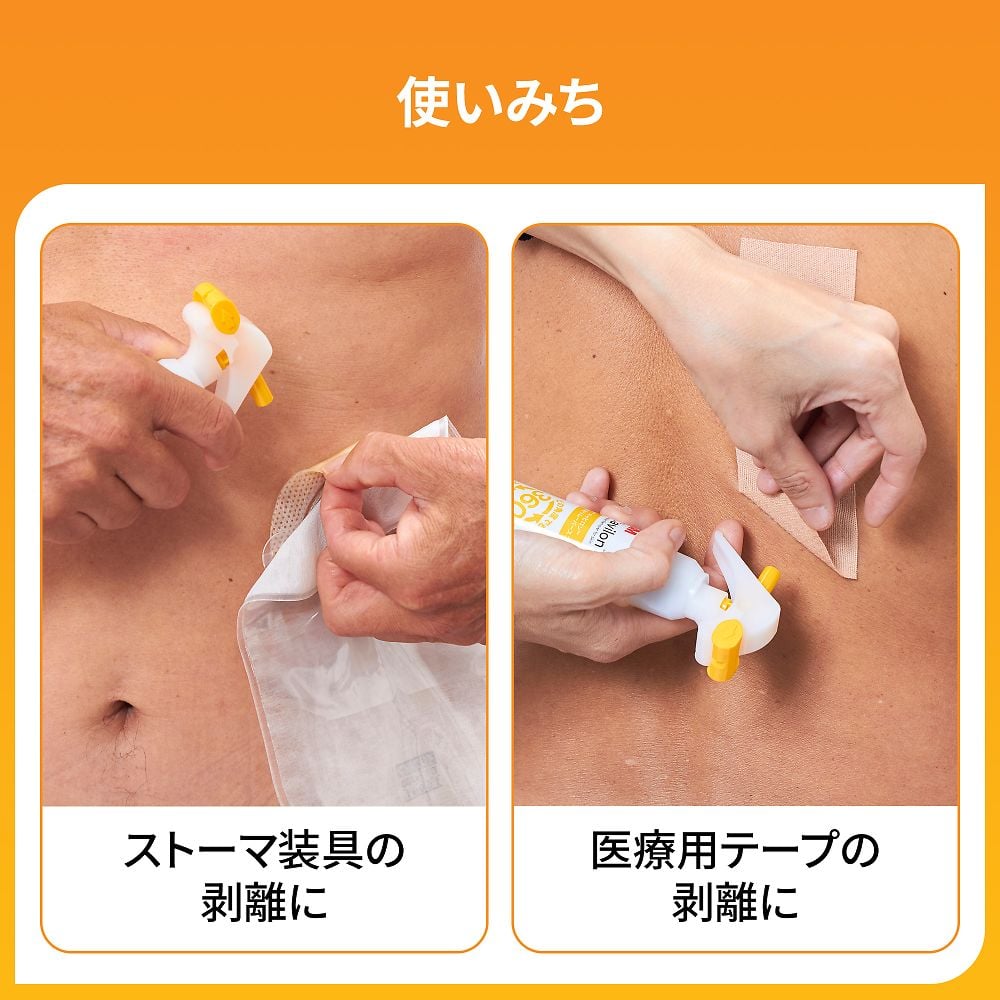 8-9093-12 皮膚用リムーバー キャビロン(TM) 1枚×30包入 TP2 【AXEL