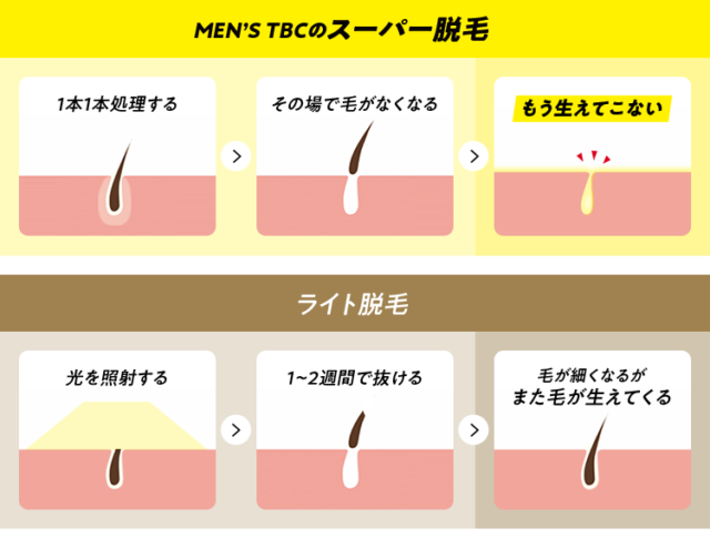 メンズTBCクリニックの口コミや評判を徹底的に調査！スーパー脱毛の
