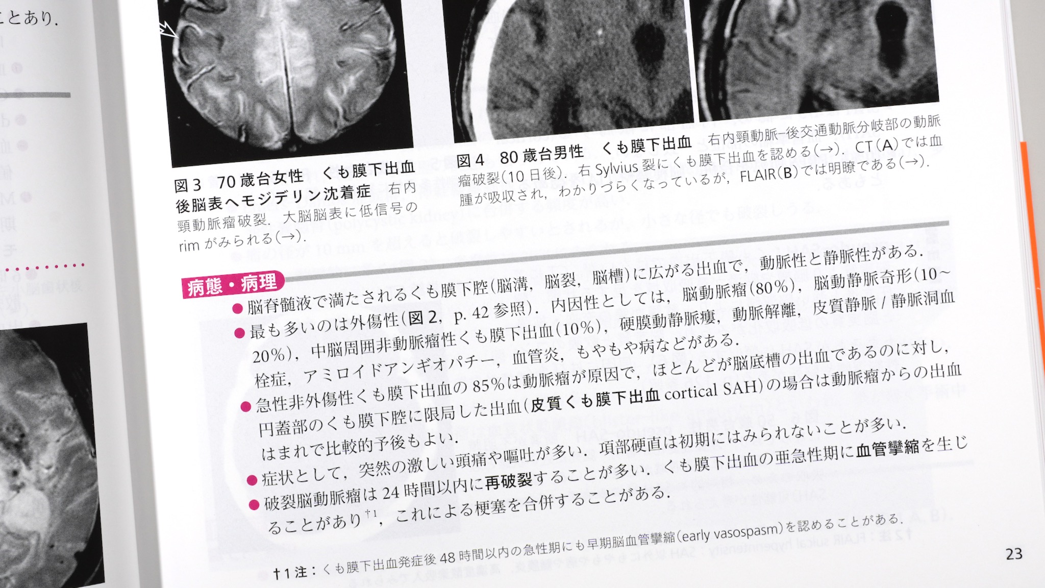 ジェネラリストを目指す人のための画像診断パワフルガイド 第2版