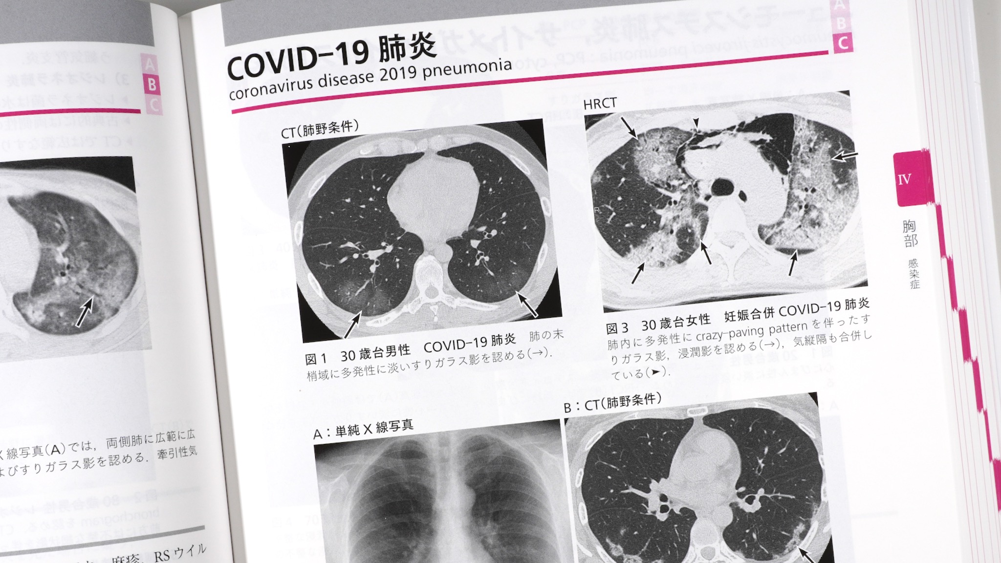 ジェネラリストを目指す人のための画像診断パワフルガイド 第2版