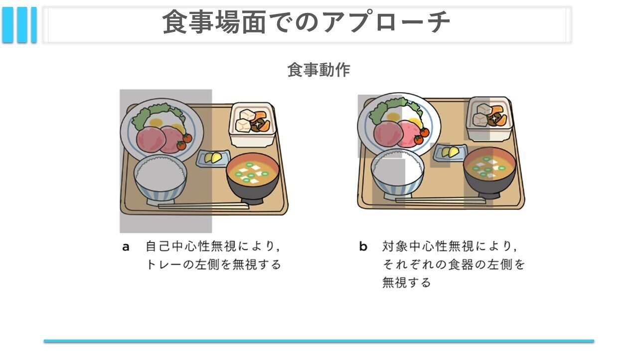 半側空間無視について④：ADLアプローチについて｜くろ 作業療法士