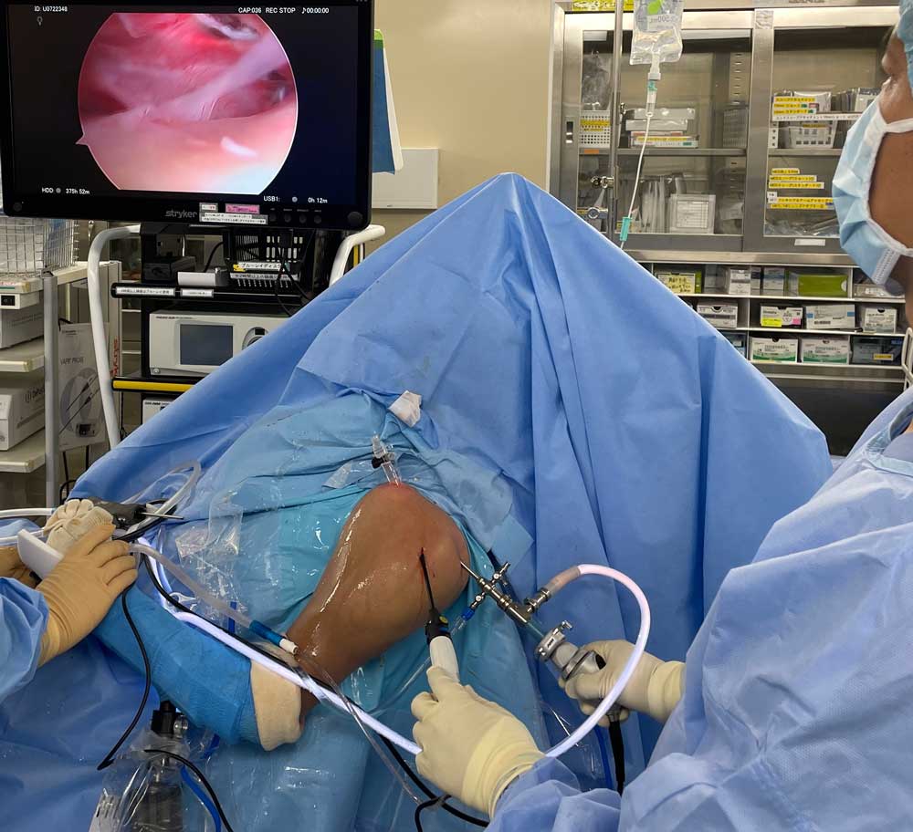 肩関節に不安がある方 - 育和会記念病院 人工関節センター