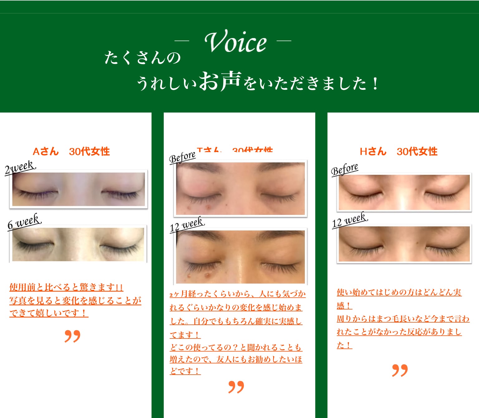 新商品】NUVEGA ラッシュRセラム＜まつげ美容液＞ | MIBELL OFFICIAL STORE