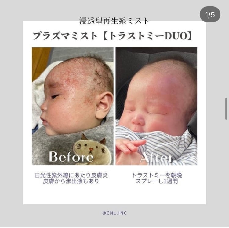 トラストミー duo(カウンセリング商品) | Dalia branca