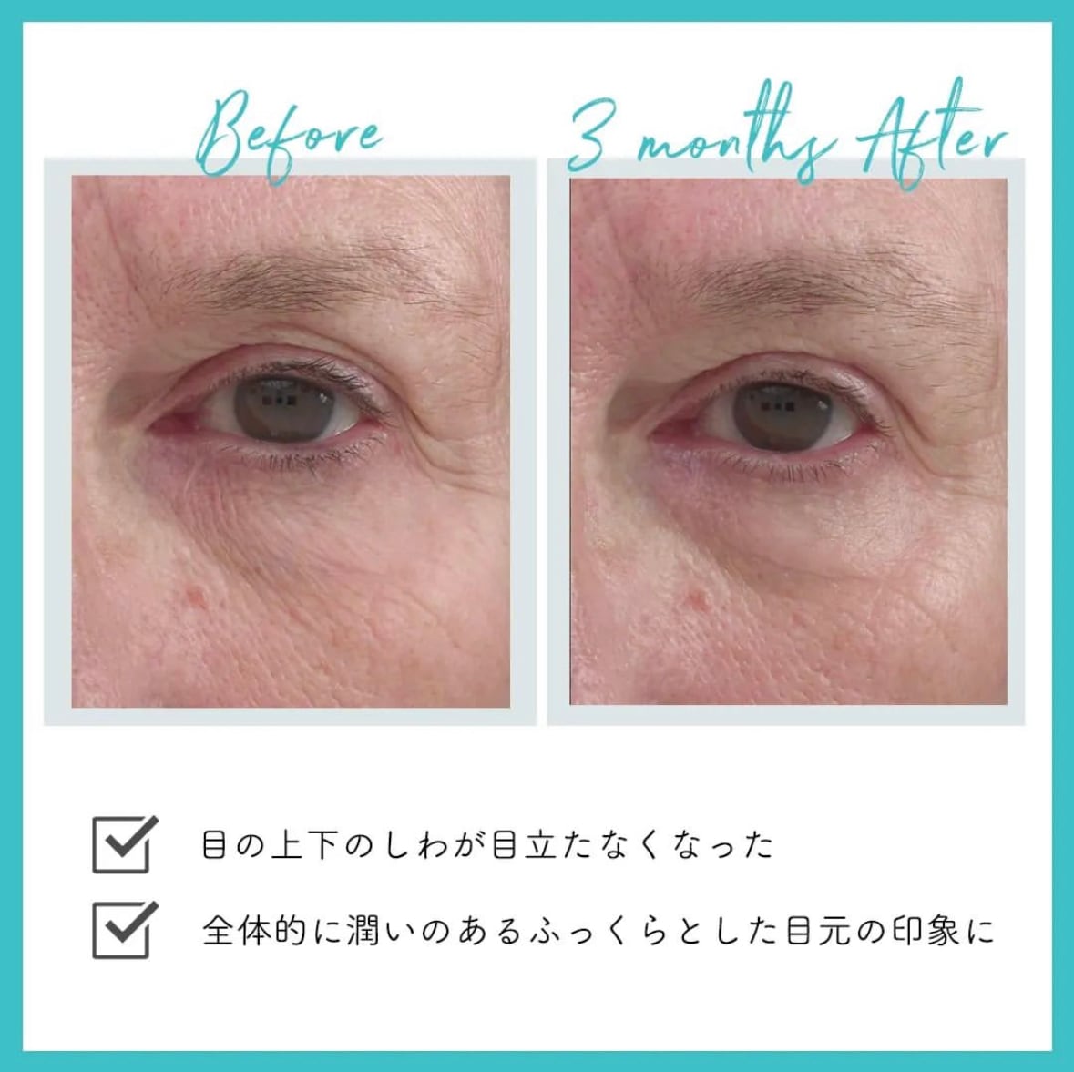 ルミネート アイジェル ジャンマリーニ | dr.label