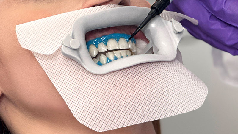 How to use - beyond Whitening | 株式会社JBAbeyond Whitening | 株式