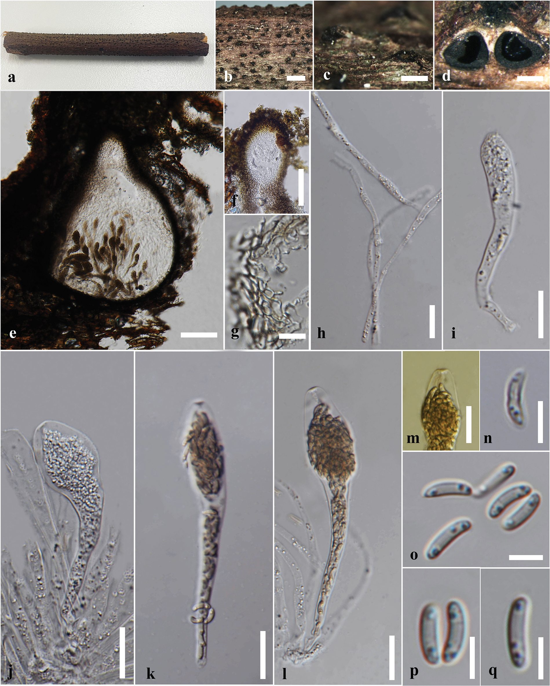 Taxonomy, phylogeny, and bioactive potential of Xylariales