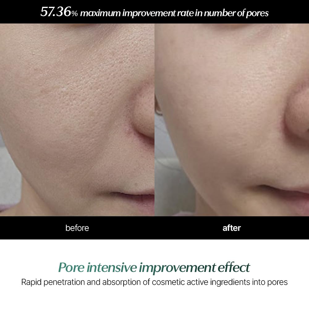 CELORABY POTENSION™ PORE REMOVER SERUM : PORE MINIMIZER