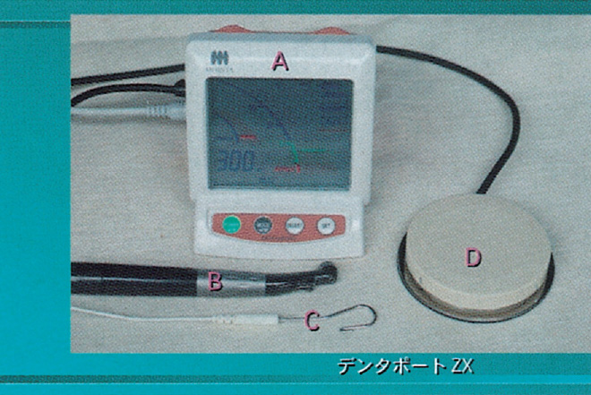 モリタ】ニッケルチタンファイルでの根管形成がエンドを変える