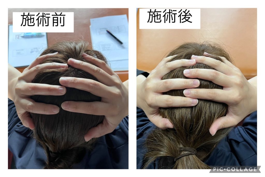 頭蓋仙骨療法（クラニオセイクラルセラピー） | フィジカルサポート