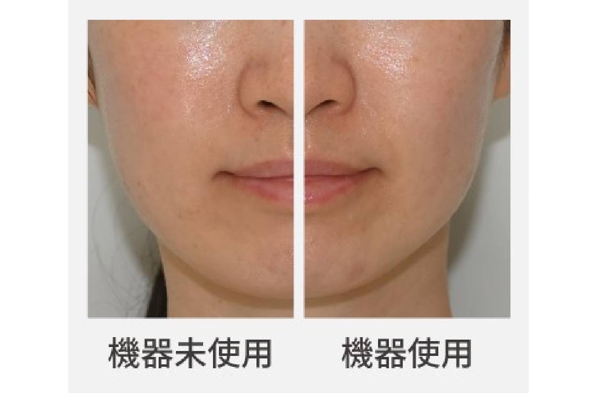 2025最新】パナソニック「バイタリフト RF EX」を徹底レビュー！従来