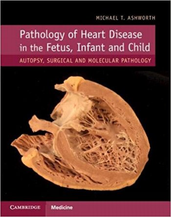 Moss & Adams' Heart Disease in Infants, Children, & Adolescents