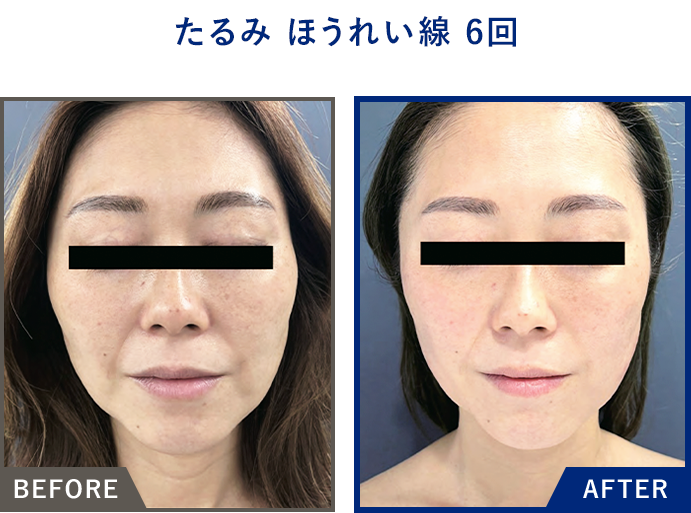 スリムビューティハウス シェイプリフト スリムビューティハウス