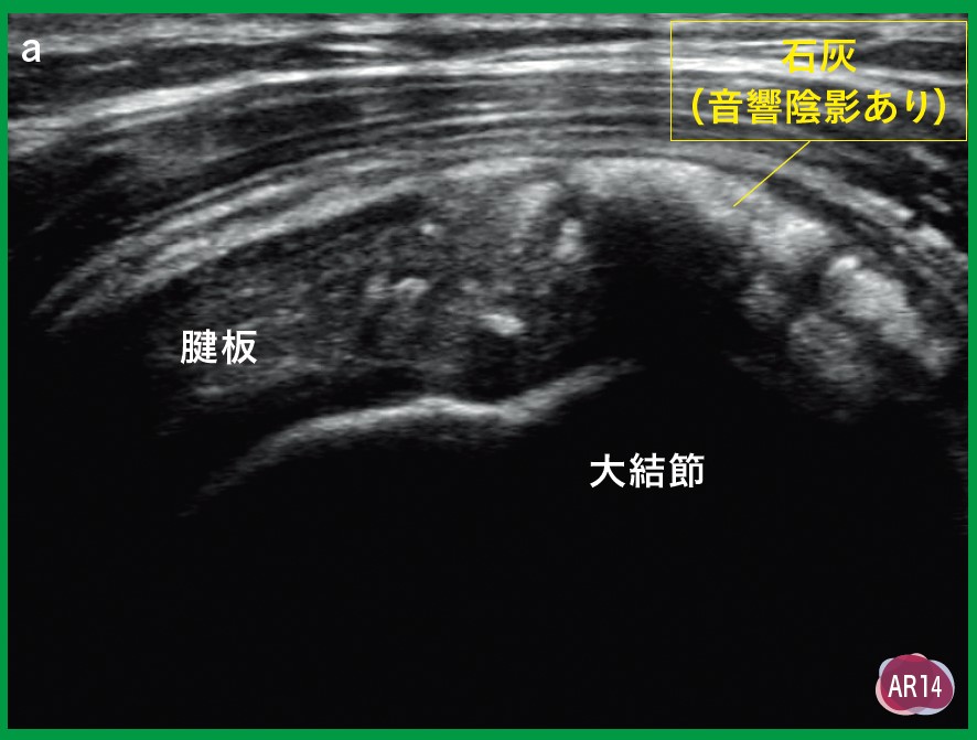 運動器エコーのメタ診療｜動画ライブラリ