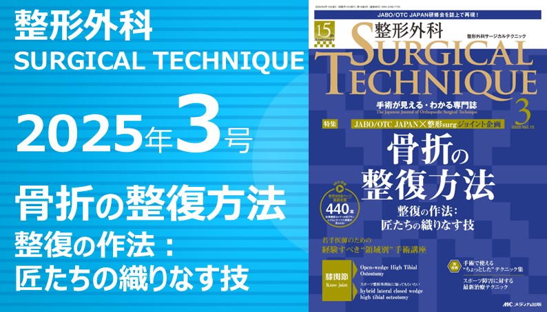 整形外科SURGICAL TECHNIQUE BOOKS 14 膝の外傷 診断・適応・手術