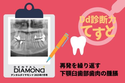 本のエッセンス｜刊行にあたって：精密歯科治療 ここまできたか