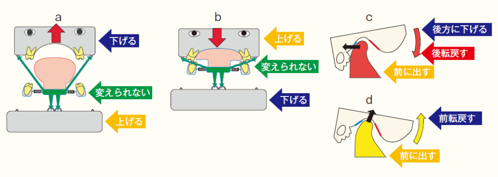 Column 直すもの間違ってませんか？｜舌骨から紐解く顎機能の謎 丸茂義